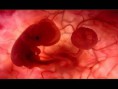 /album/fotogaleria/diapositiva11-jpg/